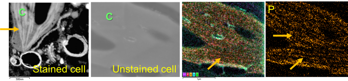 EDS of unstained plant cell & chloroplast