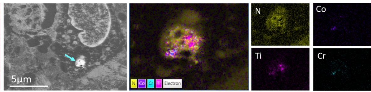 BSE image of a TEM section of human tissue